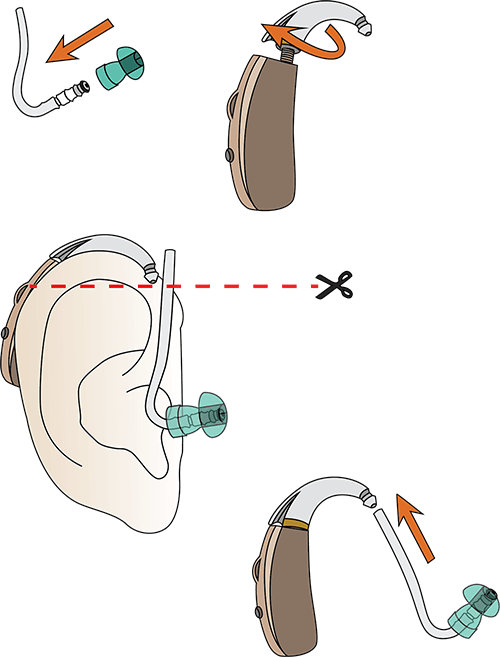 Trim thick ear tubes